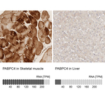 PABPC4 Antibody in Immunohistochemistry (Paraffin) (IHC (P))