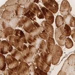 PABPC4 Antibody in Immunohistochemistry (Paraffin) (IHC (P))