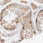 PABPC4 Antibody in Immunohistochemistry (Paraffin) (IHC (P))