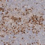 PABPC4 Antibody in Immunohistochemistry (Paraffin) (IHC (P))