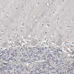 ZNF277 Antibody in Immunohistochemistry (Paraffin) (IHC (P))