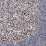 ZNF277 Antibody in Immunohistochemistry (Paraffin) (IHC (P))