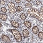 ZNF277 Antibody in Immunohistochemistry (Paraffin) (IHC (P))