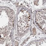 ZNF277 Antibody in Immunohistochemistry (Paraffin) (IHC (P))