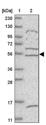 ZNF232 Antibody in Western Blot (WB)