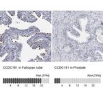 CCDC181 Antibody in Immunohistochemistry (IHC)
