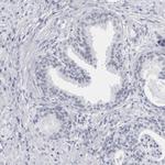 CCDC181 Antibody in Immunohistochemistry (IHC)