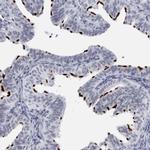 CCDC181 Antibody in Immunohistochemistry (IHC)