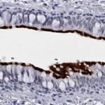 CCDC181 Antibody in Immunohistochemistry (IHC)
