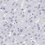 CCDC181 Antibody in Immunohistochemistry (IHC)
