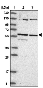 CCDC181 Antibody in Western Blot (WB)