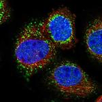 SCP2 Polyclonal Antibody