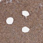 SCP2 Antibody in Immunohistochemistry (Paraffin) (IHC (P))