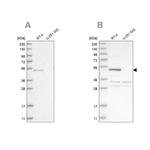 SCP2 Antibody in Western Blot (WB)