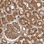 STRAP Polyclonal Antibody