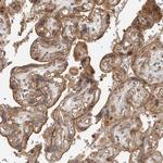 STRAP Antibody in Immunohistochemistry (Paraffin) (IHC (P))