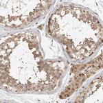 STRAP Antibody in Immunohistochemistry (Paraffin) (IHC (P))