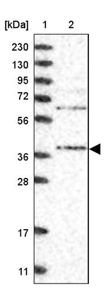 STRAP Antibody in Western Blot (WB)