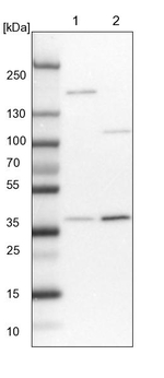 STRAP Antibody in Western Blot (WB)