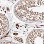 GPATCH2 Antibody in Immunohistochemistry (IHC)