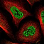 S100PBP Polyclonal Antibody