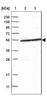 S100PBP Antibody in Western Blot (WB)