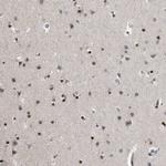 EVI5 Antibody in Immunohistochemistry (Paraffin) (IHC (P))