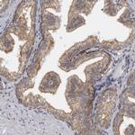 EVI5 Antibody in Immunohistochemistry (Paraffin) (IHC (P))