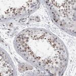 EVI5 Antibody in Immunohistochemistry (Paraffin) (IHC (P))