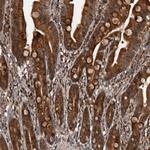 SERTAD4 Antibody in Immunohistochemistry (Paraffin) (IHC (P))