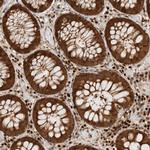 SNRNP40 Polyclonal Antibody