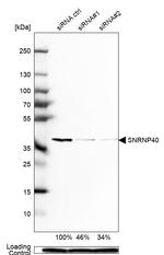 SNRNP40 Antibody in Western Blot (WB)