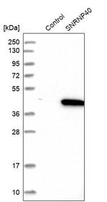 SNRNP40 Antibody in Western Blot (WB)