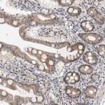 ALPK2 Polyclonal Antibody