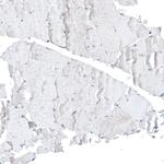 CDK20 Antibody in Immunohistochemistry (Paraffin) (IHC (P))