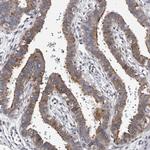 CDK20 Antibody in Immunohistochemistry (IHC)