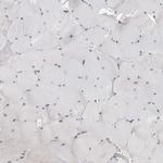 CDK20 Antibody in Immunohistochemistry (IHC)