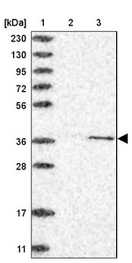 CDK20 Antibody in Western Blot (WB)