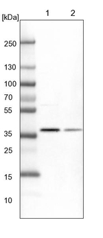 CDK20 Antibody in Western Blot (WB)