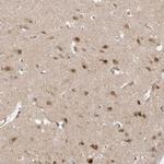 DCAF8 Polyclonal Antibody