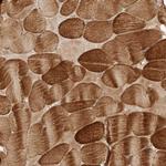 DCAF8 Antibody in Immunohistochemistry (Paraffin) (IHC (P))