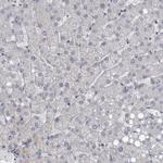 MRCK gamma Antibody in Immunohistochemistry (IHC)