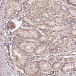 MMACHC Polyclonal Antibody