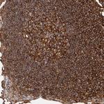 MMACHC Polyclonal Antibody