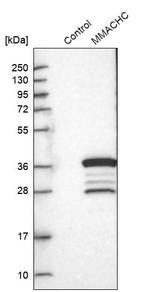 MMACHC Antibody in Western Blot (WB)