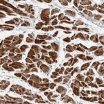 CDK20 Polyclonal Antibody