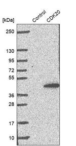 CDK20 Antibody in Western Blot (WB)
