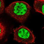 PPP1R8 Polyclonal Antibody