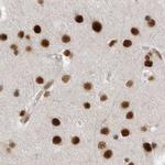 PPP1R8 Antibody in Immunohistochemistry (IHC)