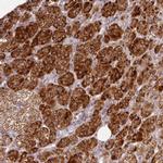 CHCHD2 Antibody in Immunohistochemistry (IHC)